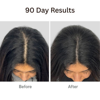 SecretBrush™ : La thérapie capillaire 4 en 1